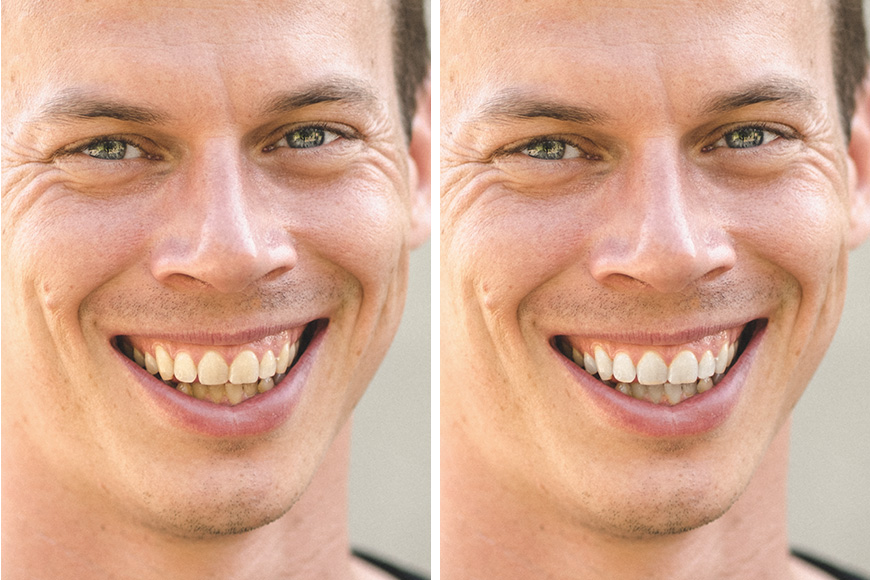 Tutorial for whitening teeth in Adobe Lightroom.