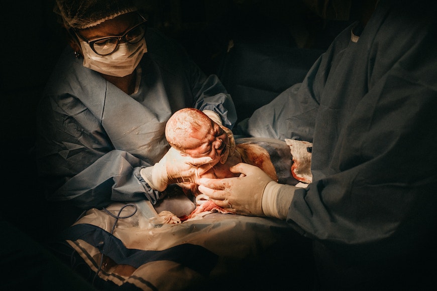birth in an operating room.