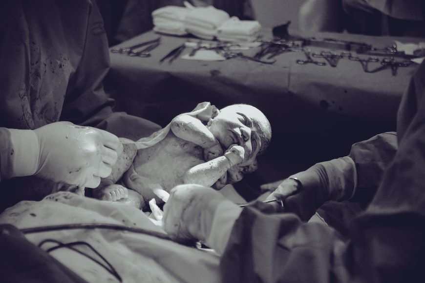 a black and white photo of a baby in an operating room.