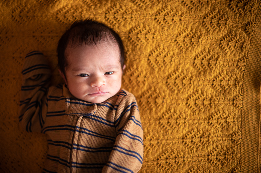 A newborn baby with a serious expression lies on a yellow textured blanket, dressed in a striped outfit.